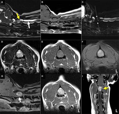 Case report: Magnetic resonance imaging features with postoperative improvement of atypical cervical glioma characterized by predominant extramedullary distribution in a dog